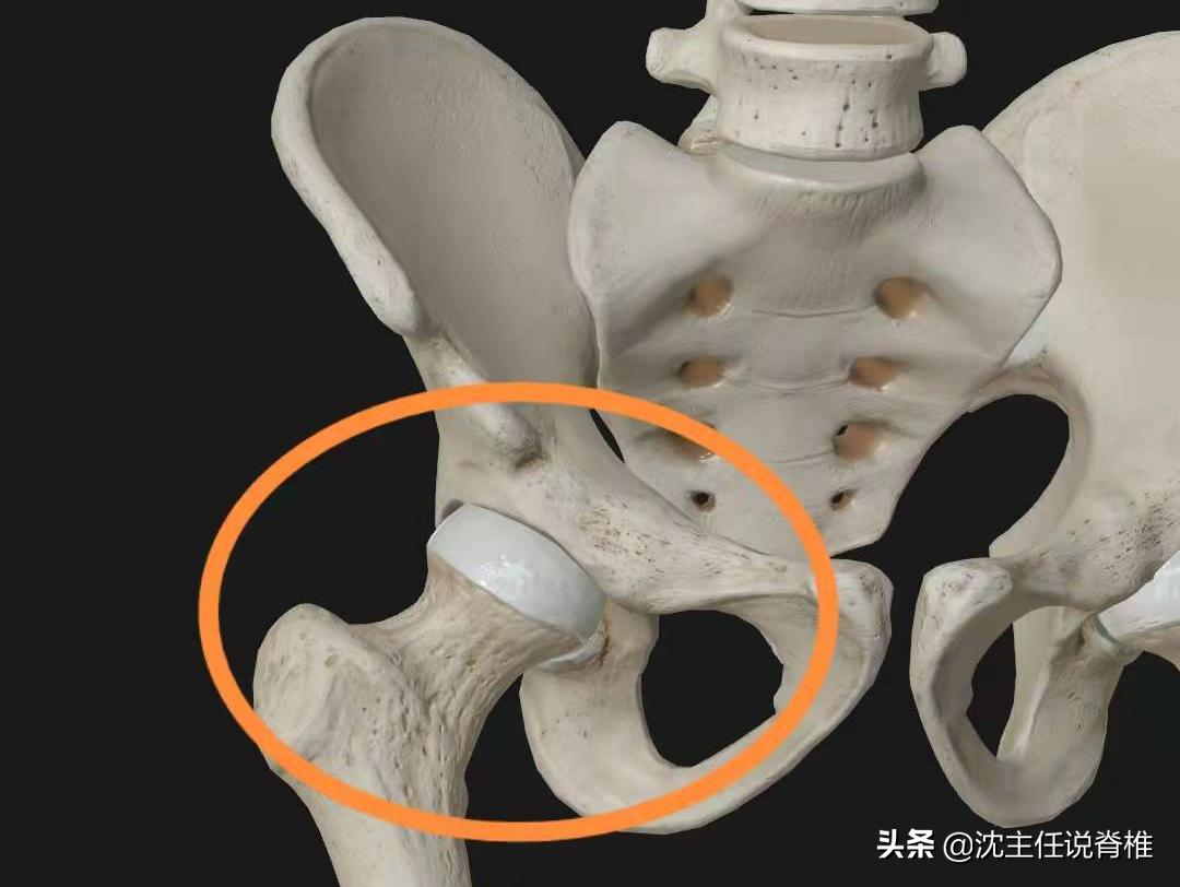 腰臀或下肢痛，是腰肌劳损、腰突症吗？不一定，还有这些原因