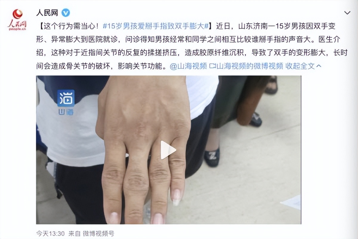 这个行为要当心！15岁男孩爱掰手指致双手变形