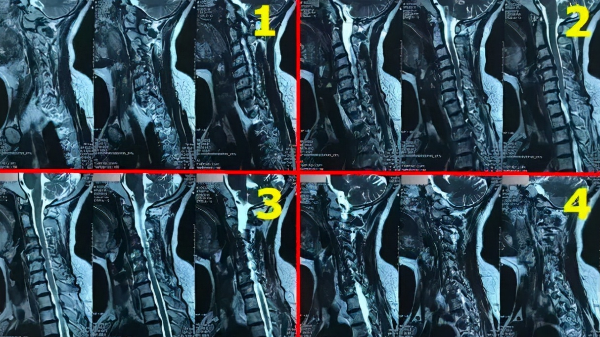 在家也能拍高清X线、CT、磁共振片？医生教你几招，在家轻松看病