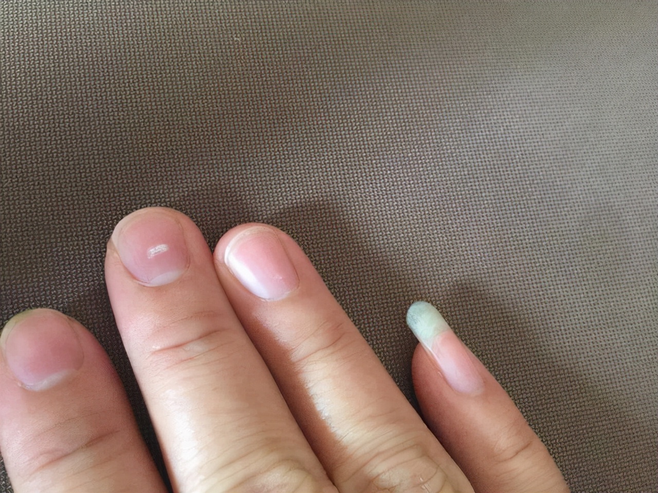 手指甲为什么会出现“竖纹”？指甲常出现的几个问题，建议了解下