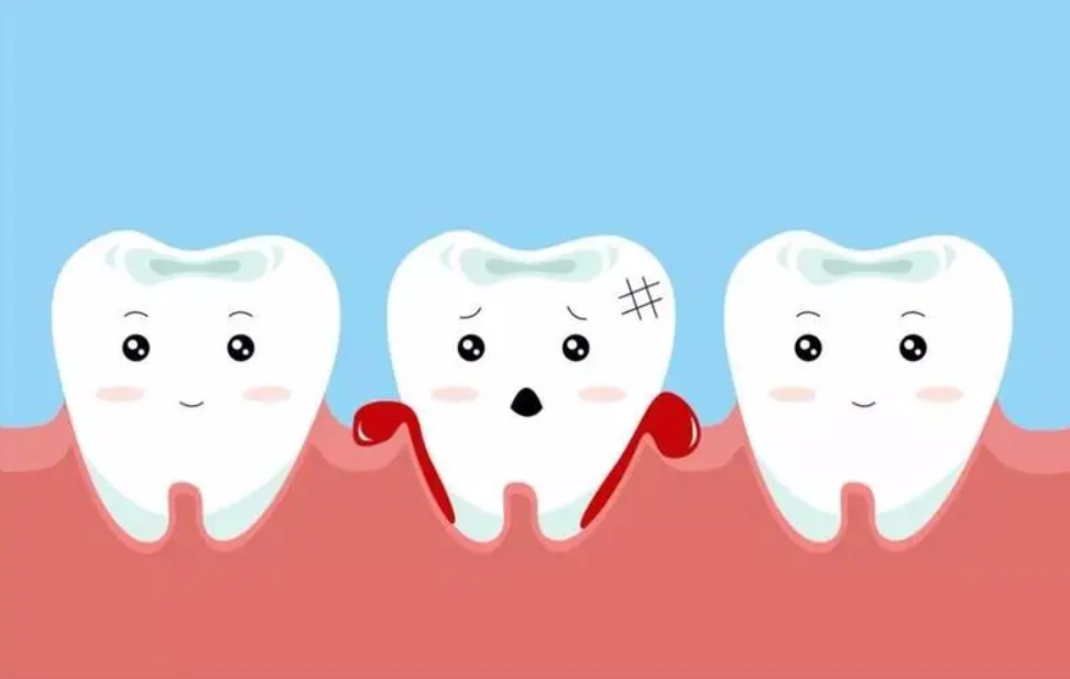 肝不好的人要管住嘴巴，口腔有这4种变化，提示肝硬化