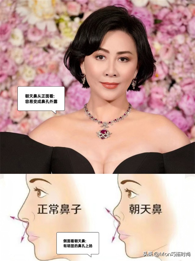 事实证明，美貌的天敌不是朝天鼻，而是“下撇唇”，显老又苦相