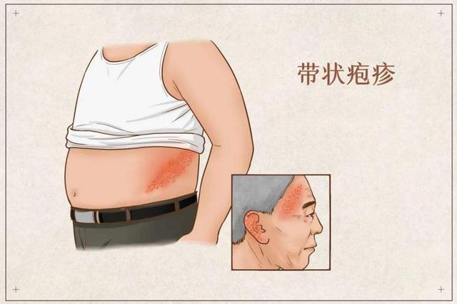 世界上最疼的病是什么病？疼痛排名前4的疾病，经历过的都是王者