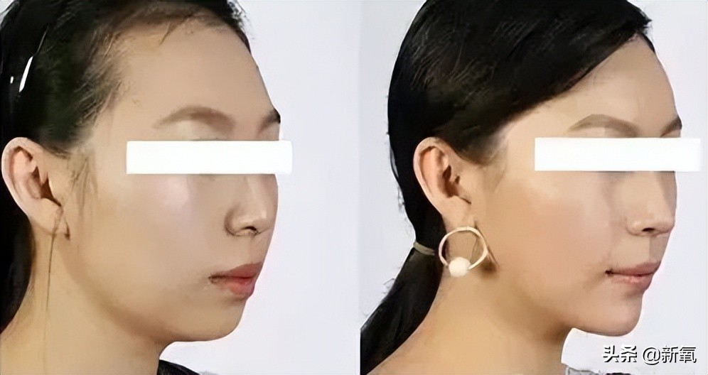 暴瘦30斤还瞬间丑10倍？她也太预言家了…