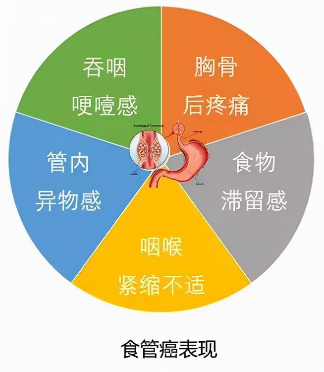 「居家1號飯」全球一半的食道癌患者在中國，究竟為何？