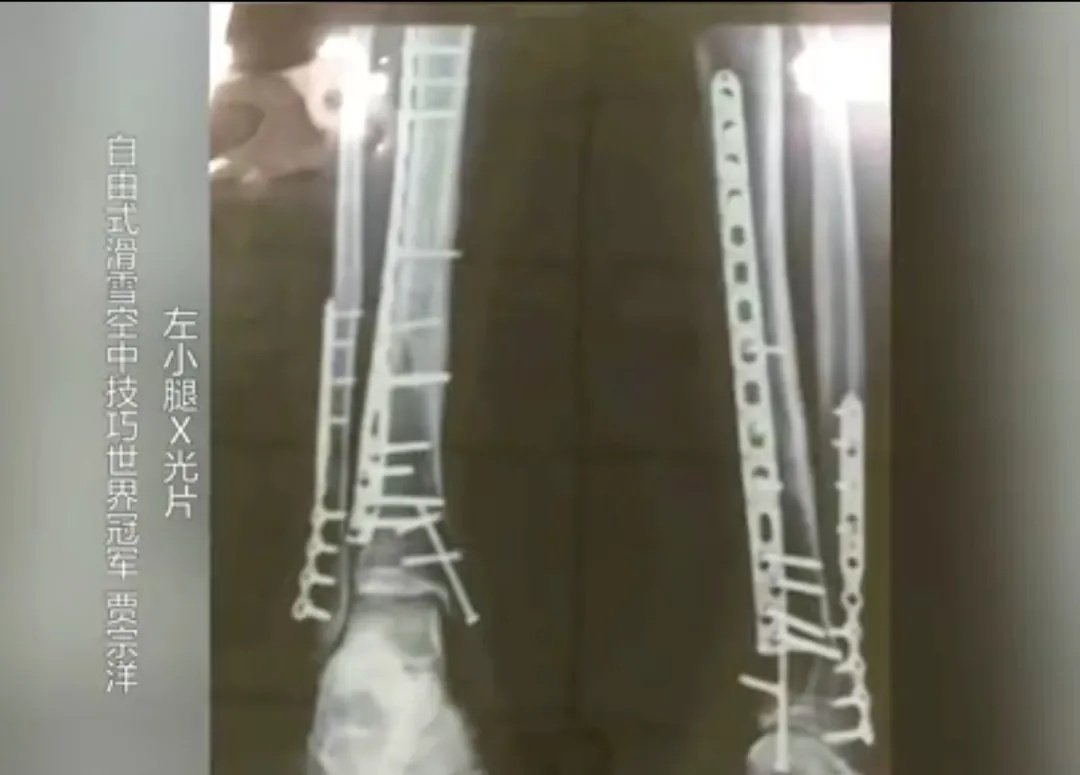 又创造了历史！感到自豪