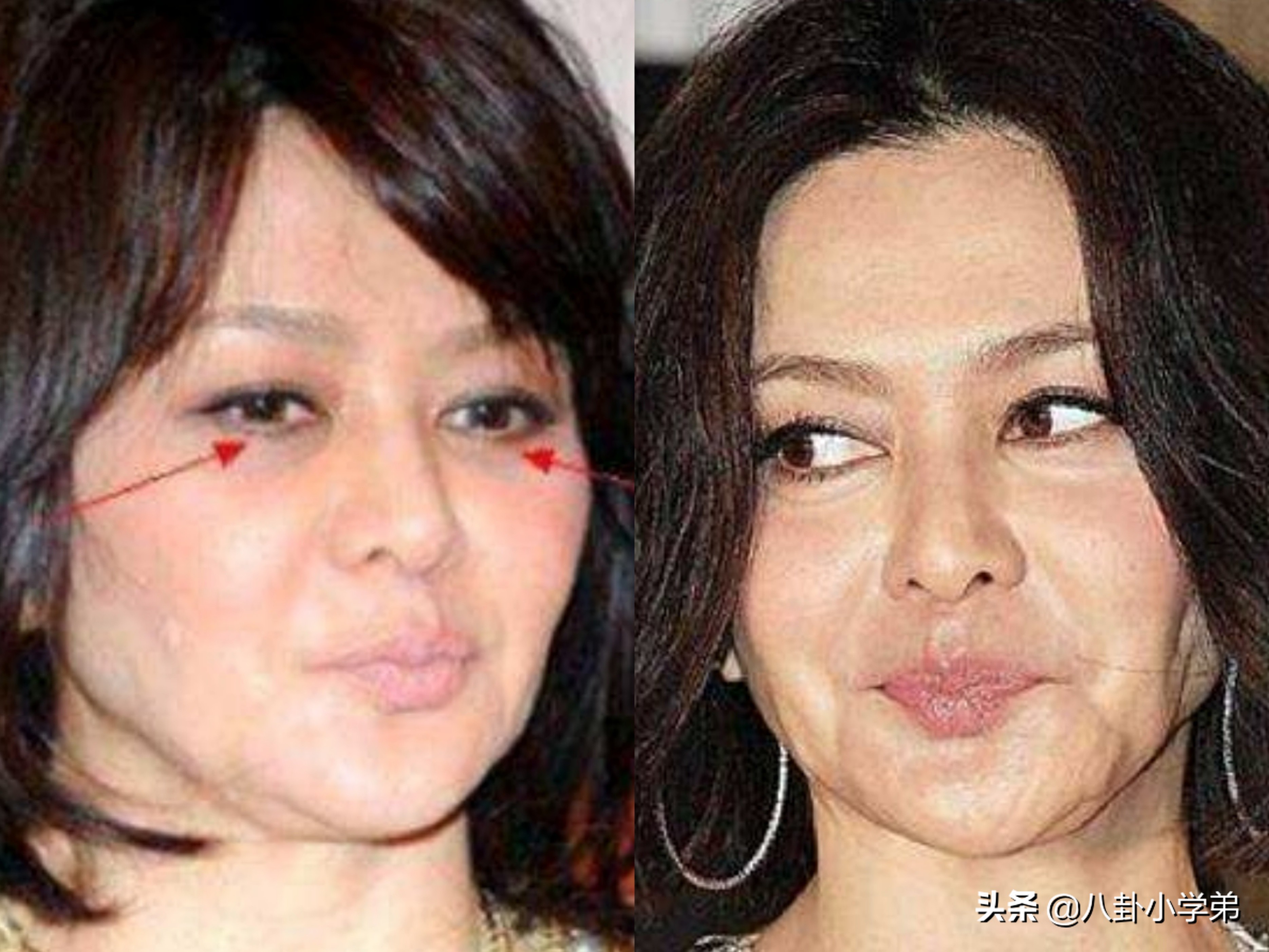 “不老女神”跌落神坛，年过50岁装少女，整容P图一个比一个厉害