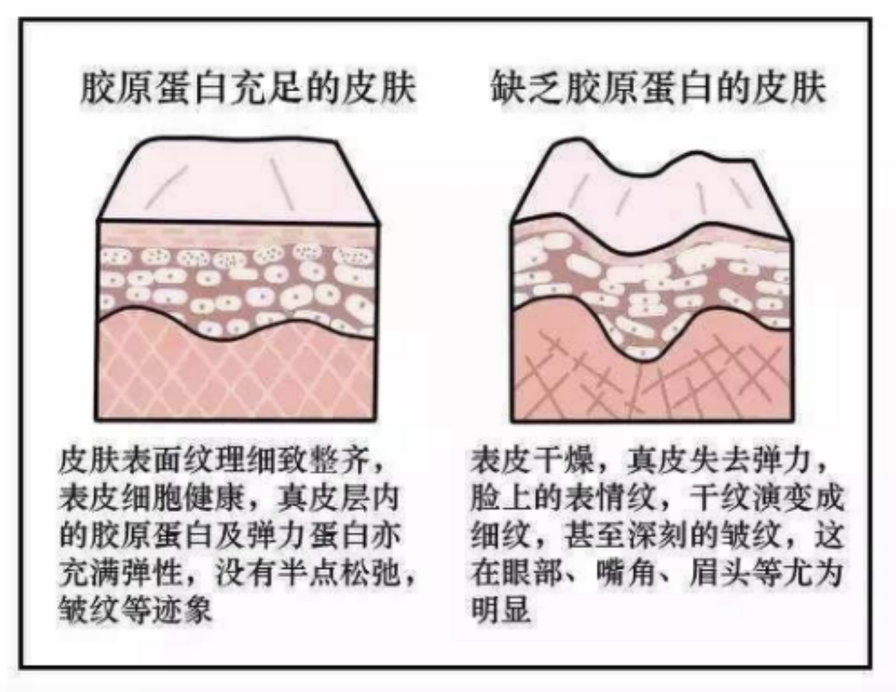 虎斑心病理图图片