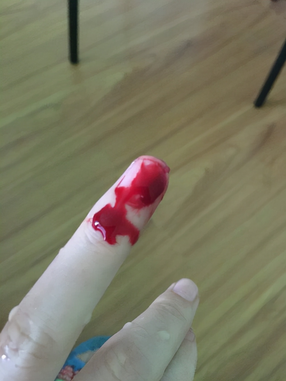 我们为什么会流血?一位血液学家解释了身体如何防止受伤后失血