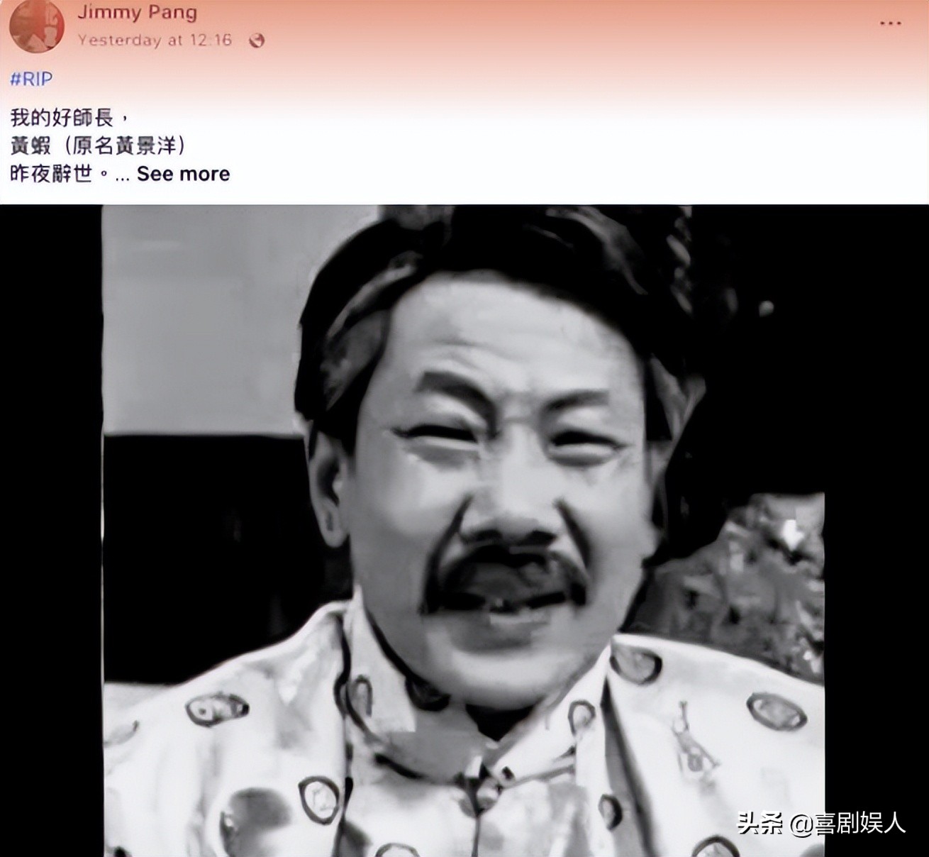 年轻时是人上人，晚年生活心酸，这9位巨星，最惨的靠洗肾续命