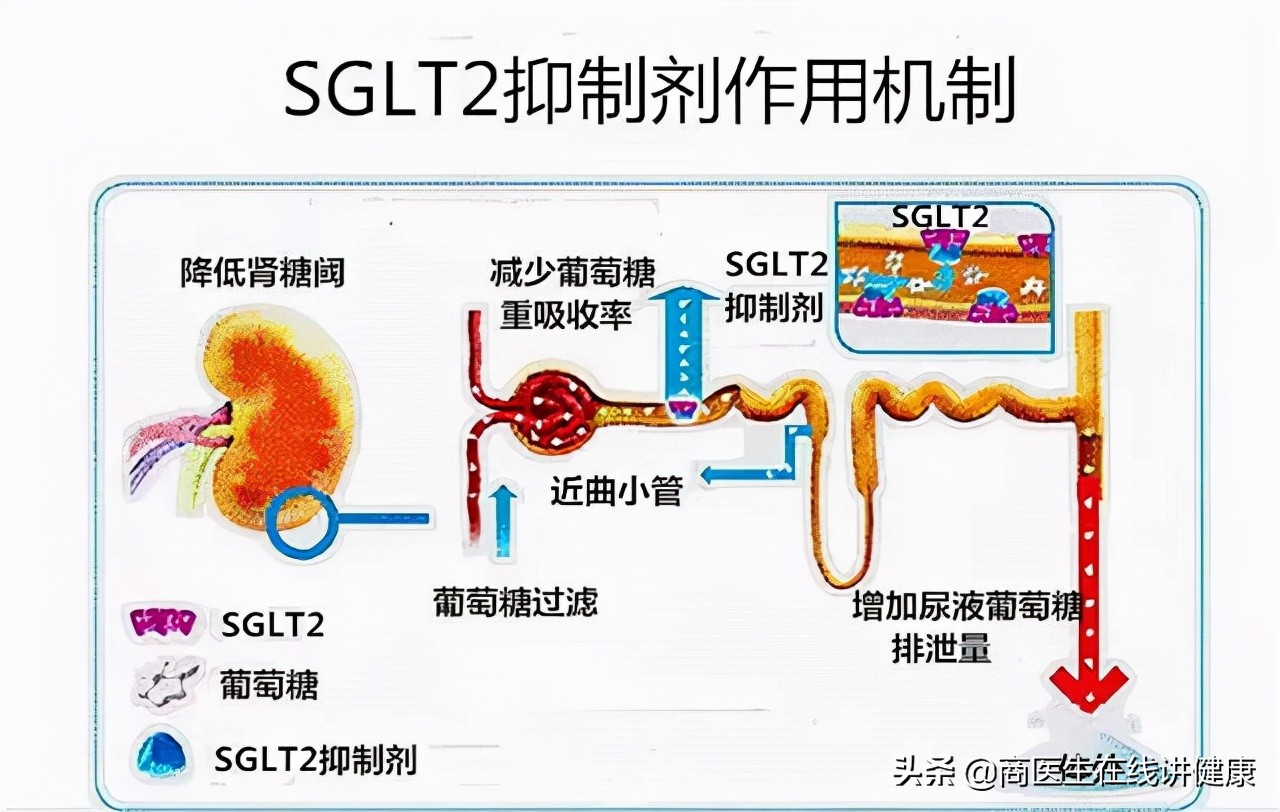 2个降糖新药进医保，降压降脂减重，改善胰岛素抵抗，保护心血管