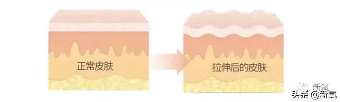 懷孕到底會給女性帶來什麼變化?如何通過醫美改善?