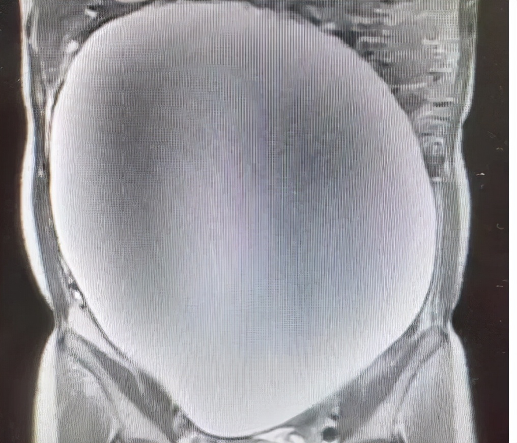 体内有癌，腹部先知？腹部的3个异常表现，或是暗示癌症已来临