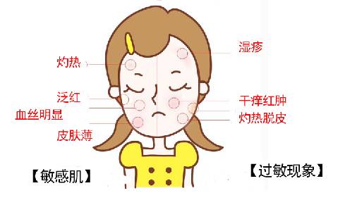 敏感肌肤形成原因及有效降敏方法解析