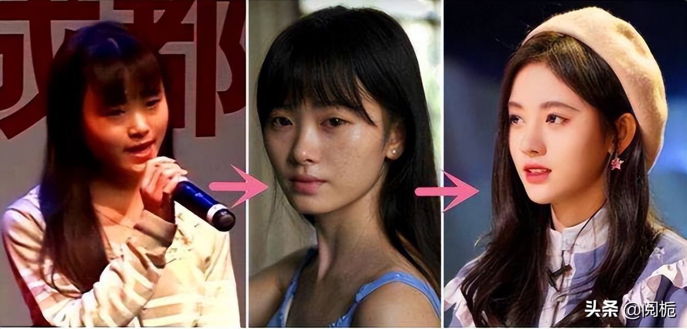 盘点9位整容女星有人换头改命成一线有人适得其反断前途