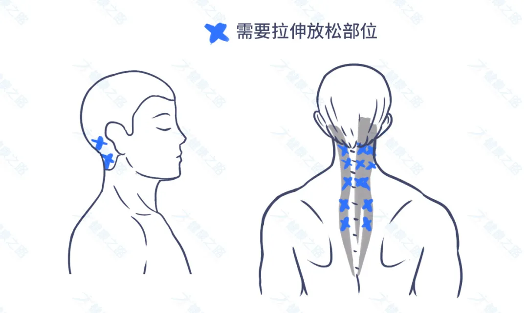 1个马上缓解头痛的方法,简单有效,还能预防颈椎病