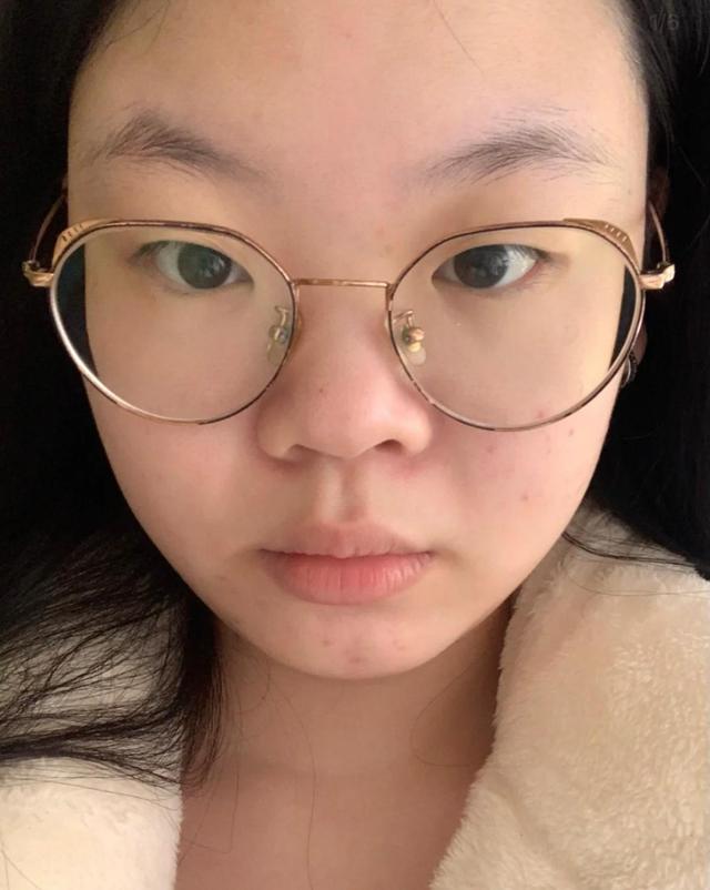 蒜头鼻子图片(别让) - 赤虎壹号