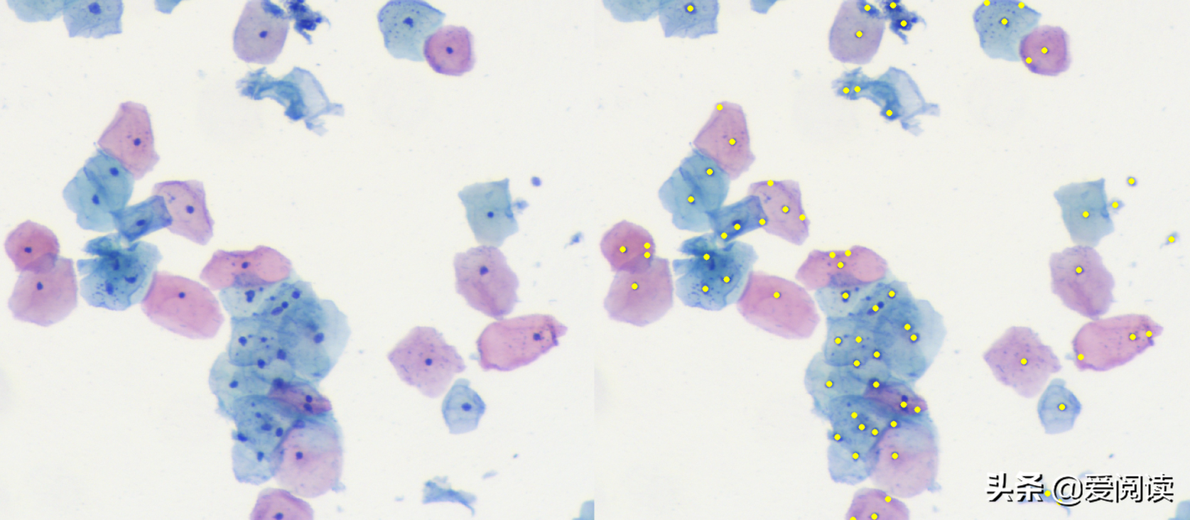 你试过吗？图像（细胞）分割