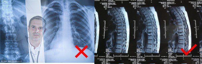 在家也能拍高清X线、CT、磁共振片？医生教你几招，在家轻松看病