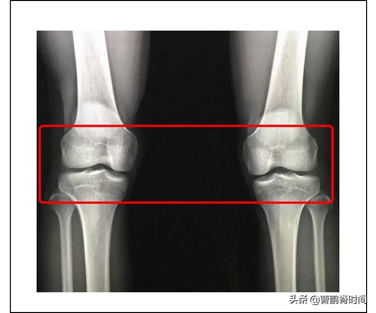 增高密码系列之：如何预判孩子的身高？