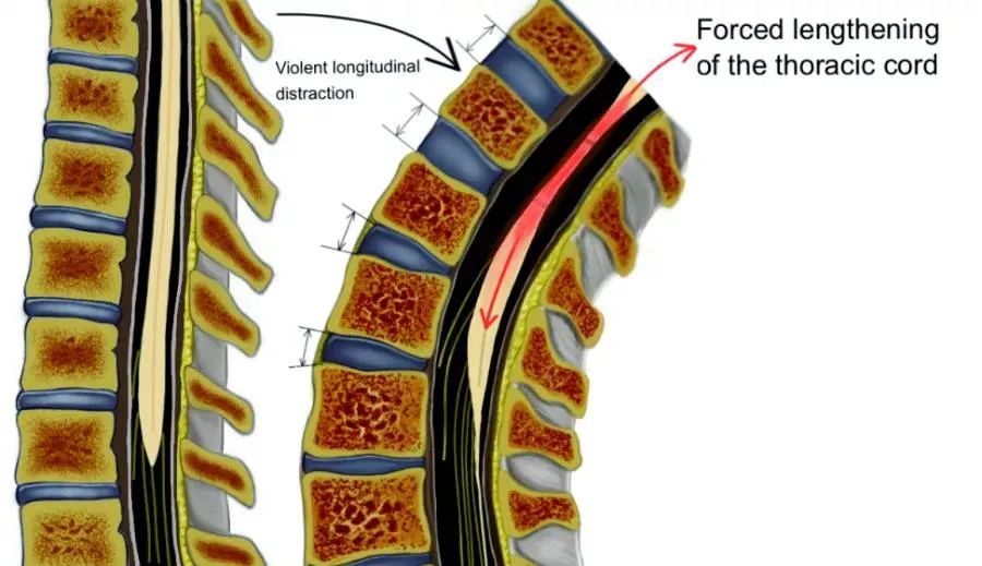 舞蹈，是危险的兴趣班，别被环境和老师误导，娃没天分，别硬学