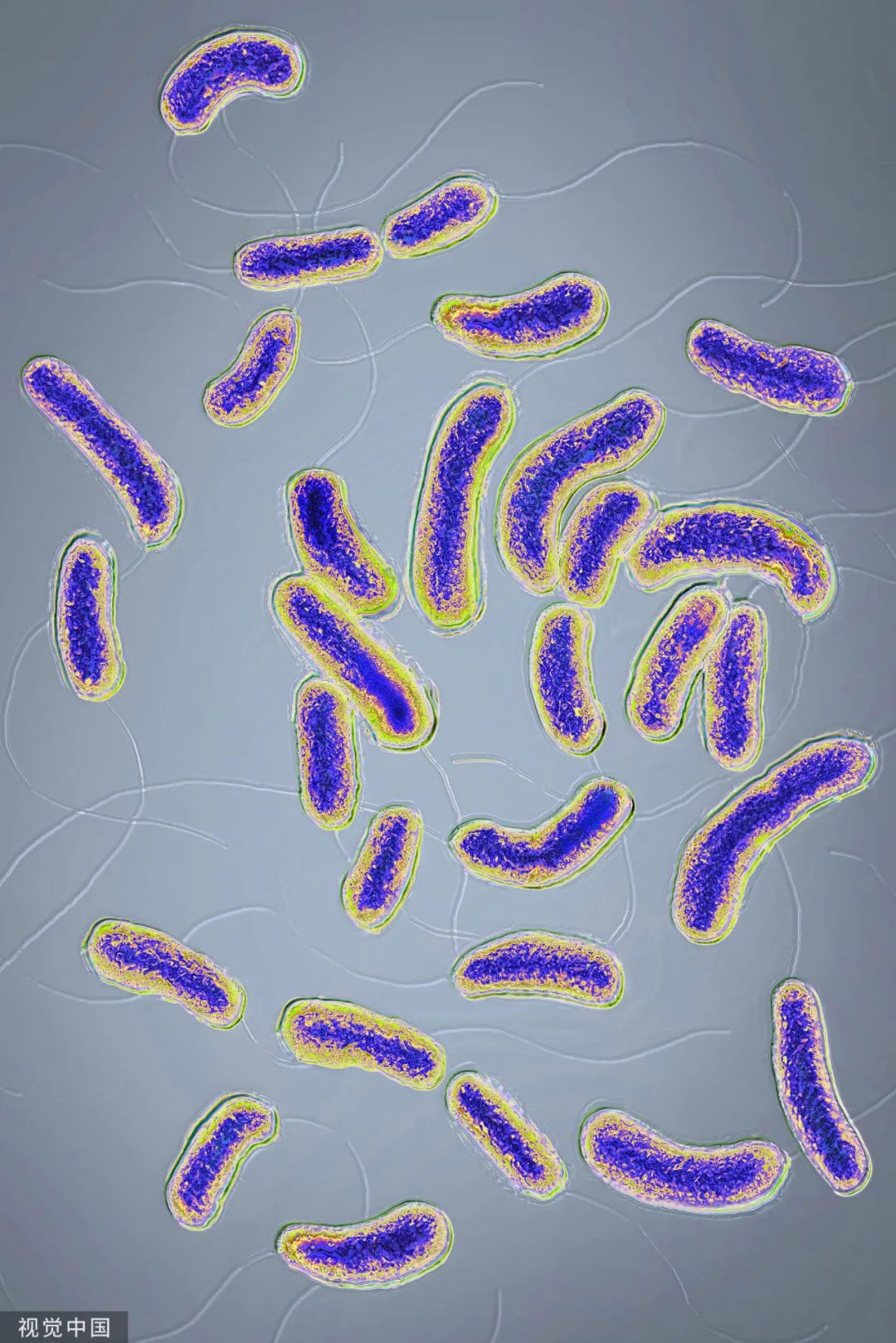 霍乱是由霍乱弧菌所引起的一种急性腹泻性传染病,主要通过被污染的水