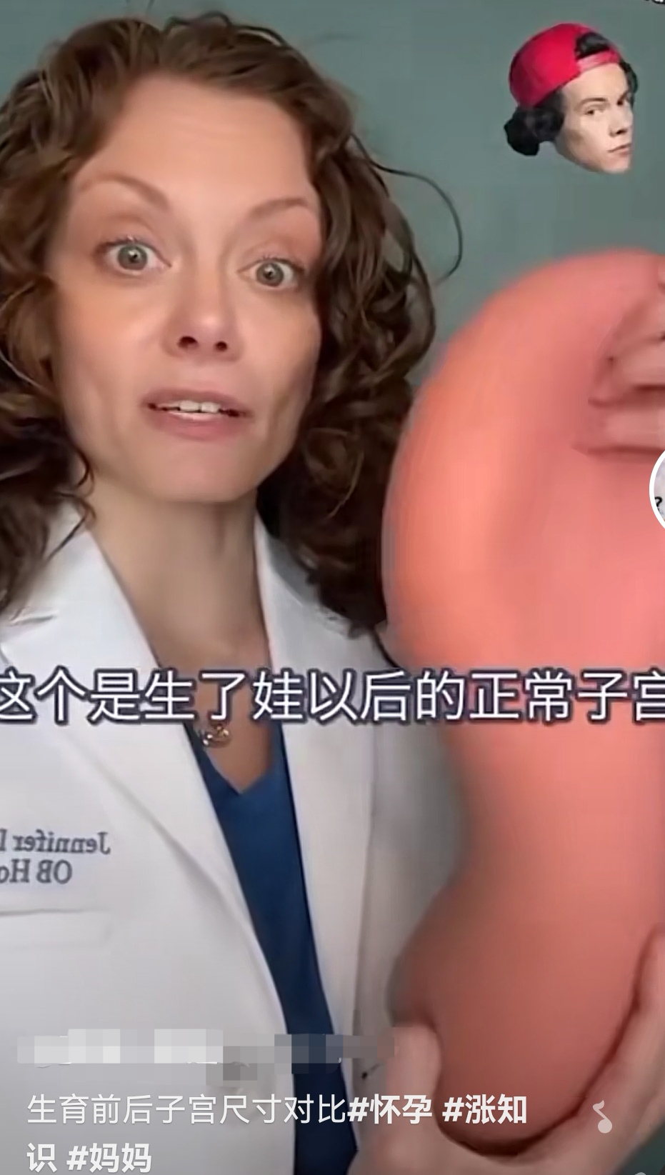 生育前后子宫大小差别多大?一张图帮你明白,产后恢复不会那么快