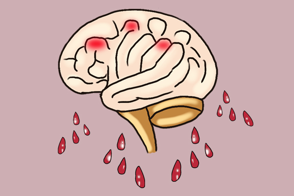 “体虚”分气虚、血虚、阳虚、阴虚，你是什么虚？一文为你解答