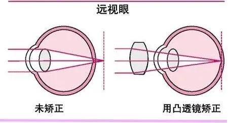 凸透镜成像原理,凸透镜成像原理公式