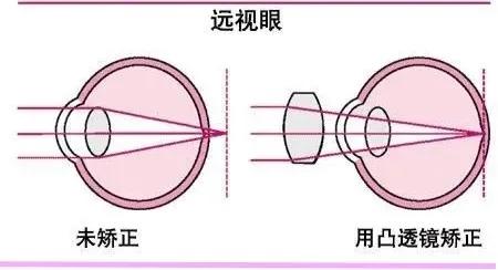 凸透镜成像原理,凸透镜成像原理公式