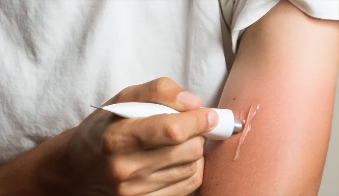 红霉素软膏，在眼部涂两下，对身体影响有多大？建议来了解下