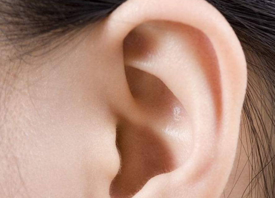 女人右耳朵热什么预兆(耳朵总是容易痒是怎么了) - 百百科