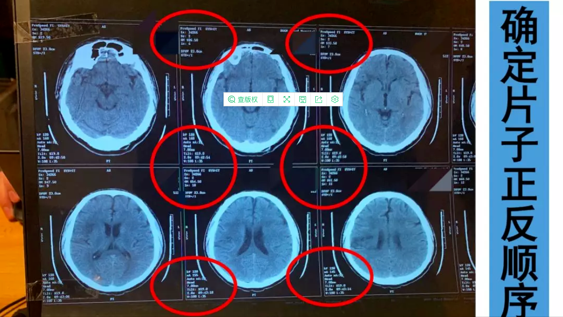 在家也能拍高清X线、CT、磁共振片？医生教你几招，在家轻松看病