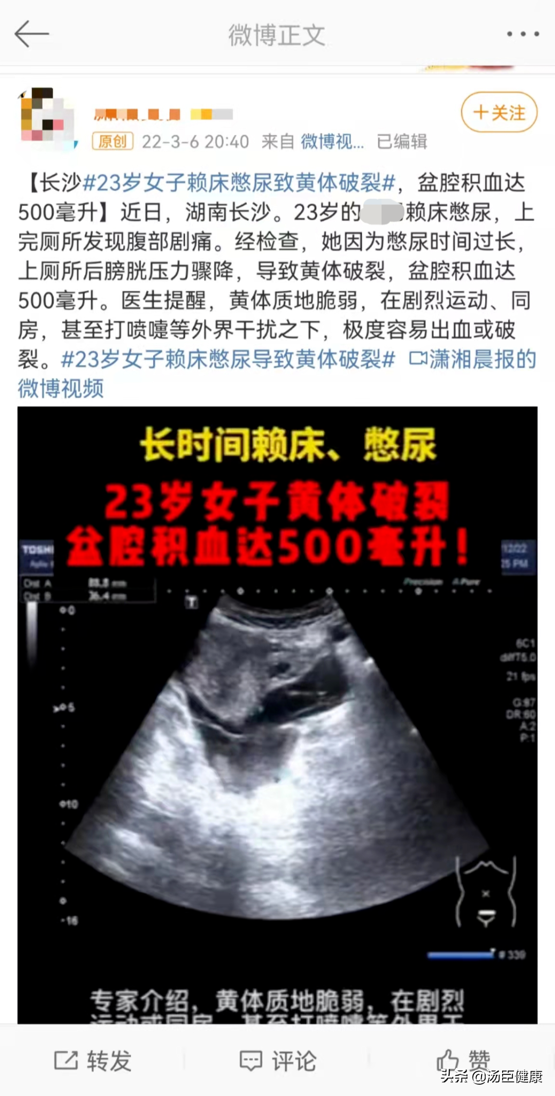 久坐的人每天憋尿，憋多久会膀胱“爆炸”？