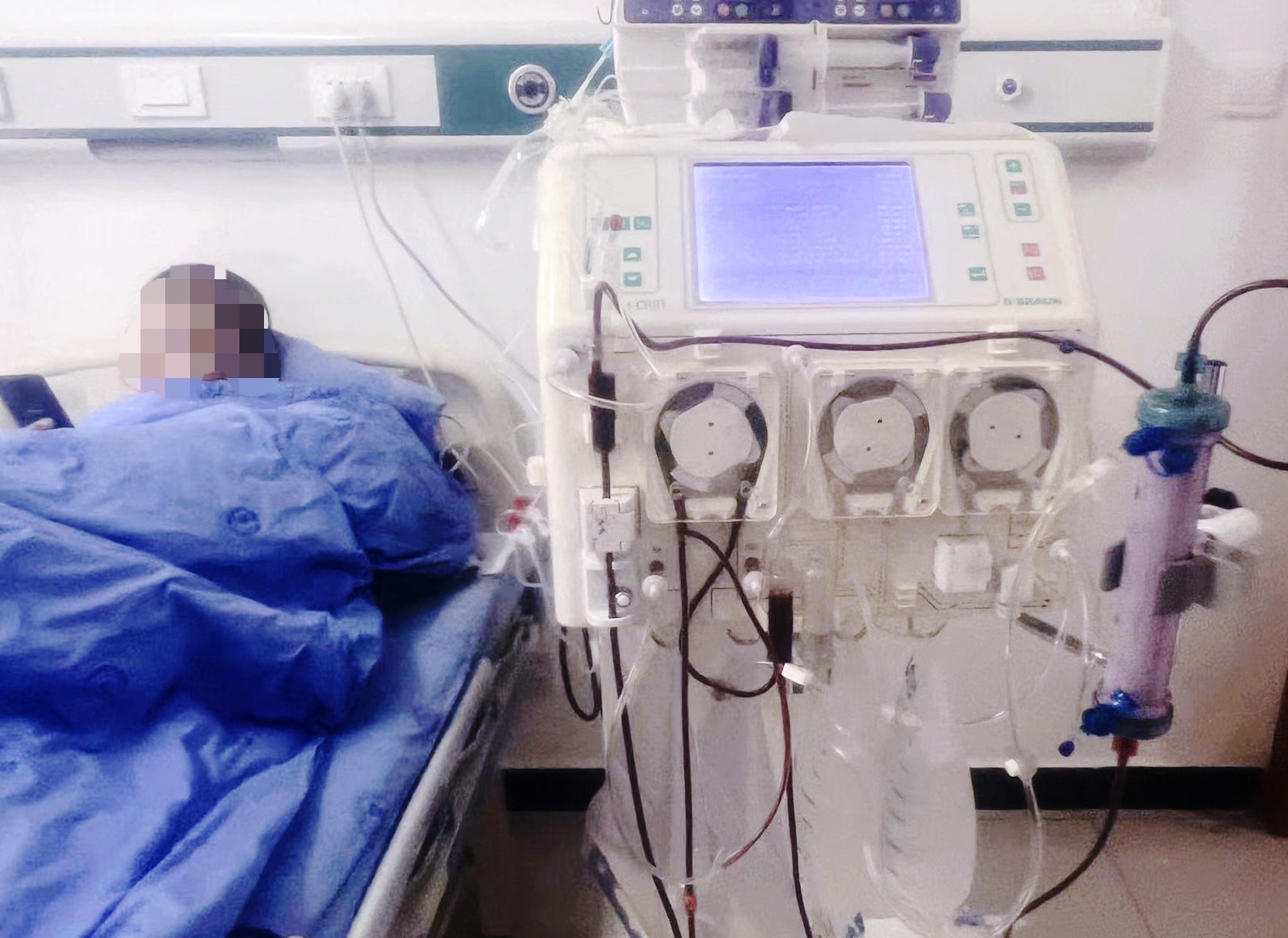 大邑县人民医院：几千里返乡路，尿毒症患者的血透不耽误