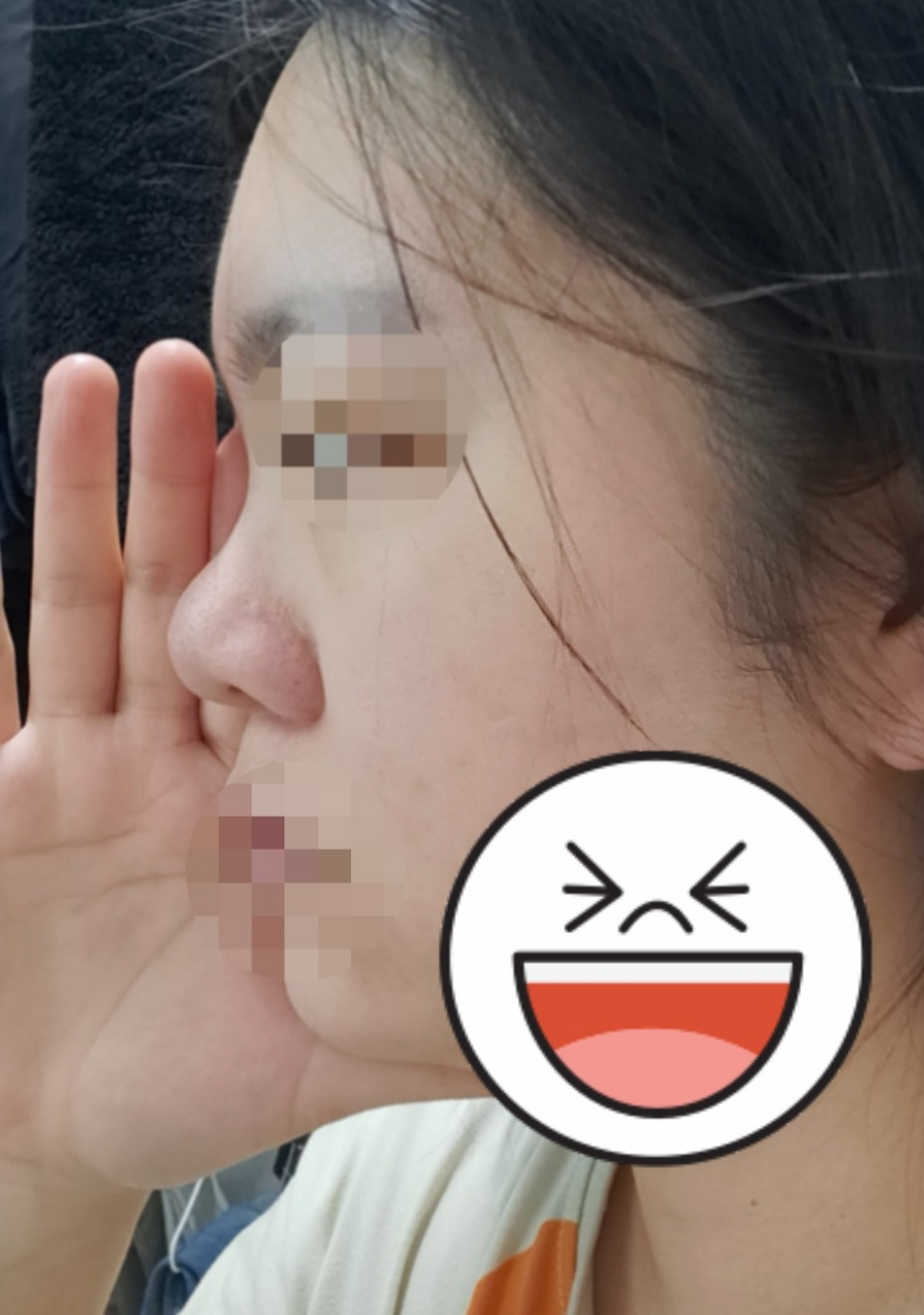 好看的鼻子真的能给你带来好运？38岁女士告诉你真实情况