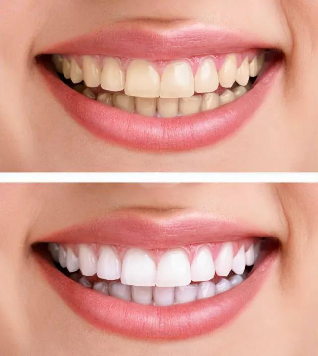 在娱乐圈中有多假，几乎全身任何地方都可以“人造”