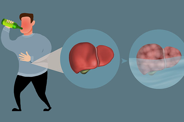 肝不好的人适合吃什么、不适合吃什么？列出“红黑榜”，不妨参考