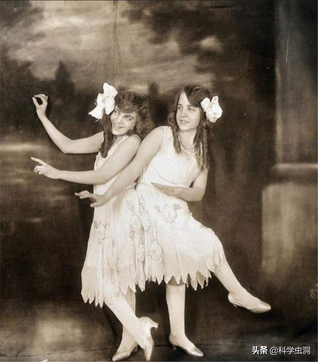 连体姐姐死后,妹妹被迫和遗骸生存2天