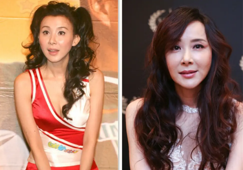颜值忽高忽低、脸部时好时坏，这些灵动的女明星，都被医美坑惨了
