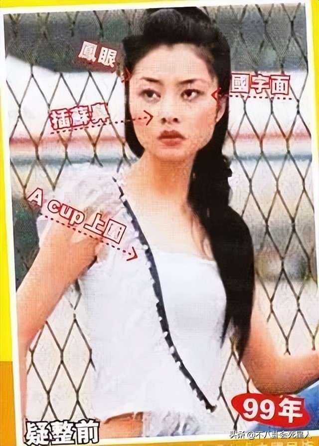 基因骗不了人！5位明星动脸“改命”，孩子却跟他们整容前一样
