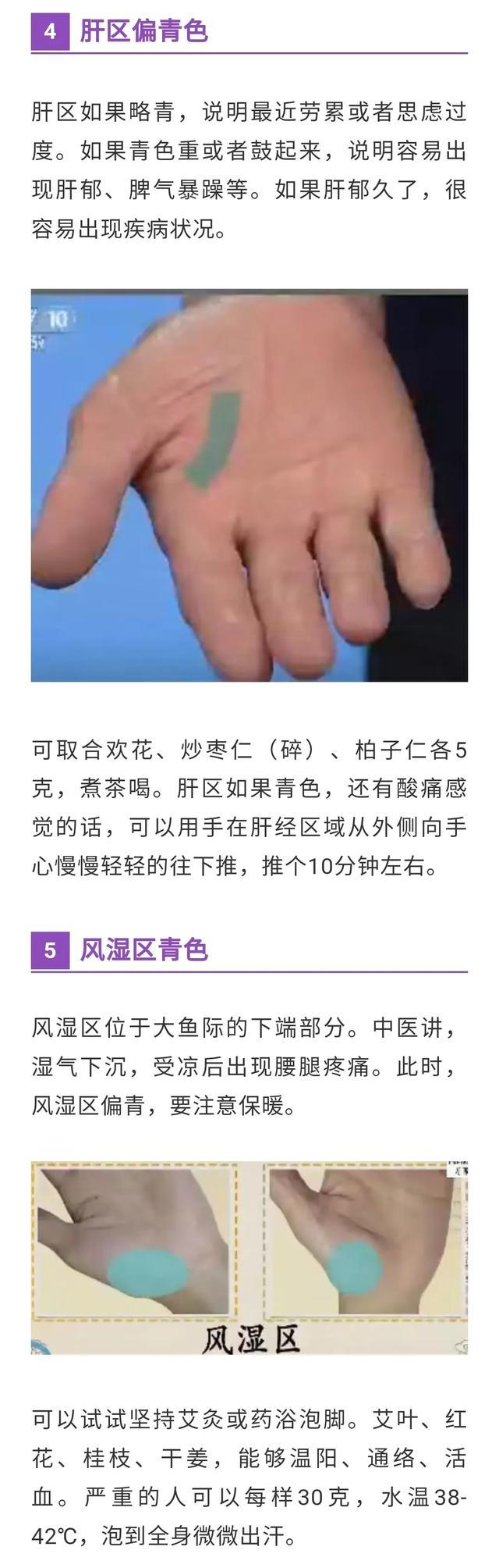 手诊：常见的10种疾病，中医建议收藏，学习