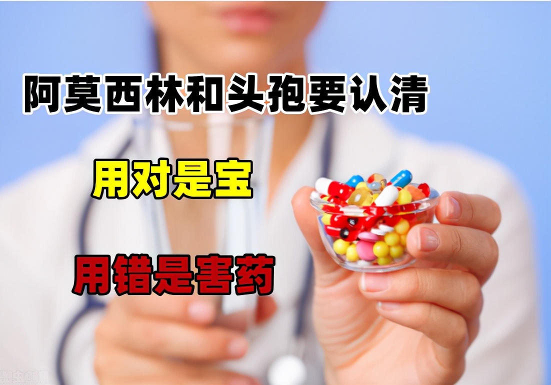两大抗生素"阿莫西林"和"头孢"要认清,用对是宝,用错是害药