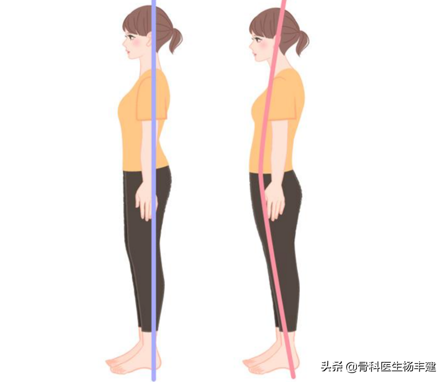 对身高不满意？骨科医生：做好这 4 点，身体还能高一点