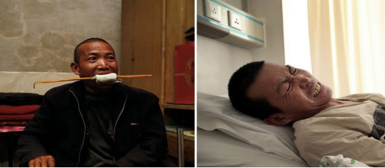 2012年，河北硬汉为省医疗费自锯病腿，没有麻药疼得咬断4颗牙