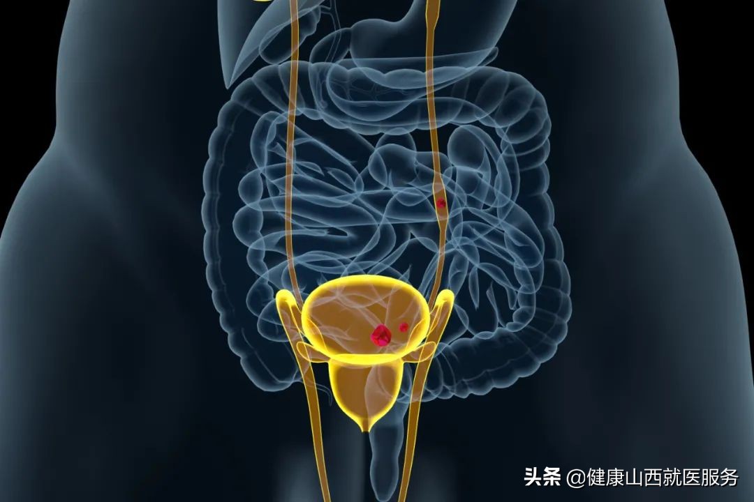 尿频、尿急、尿痛别怪肾不好！可能是你的下面生病了
