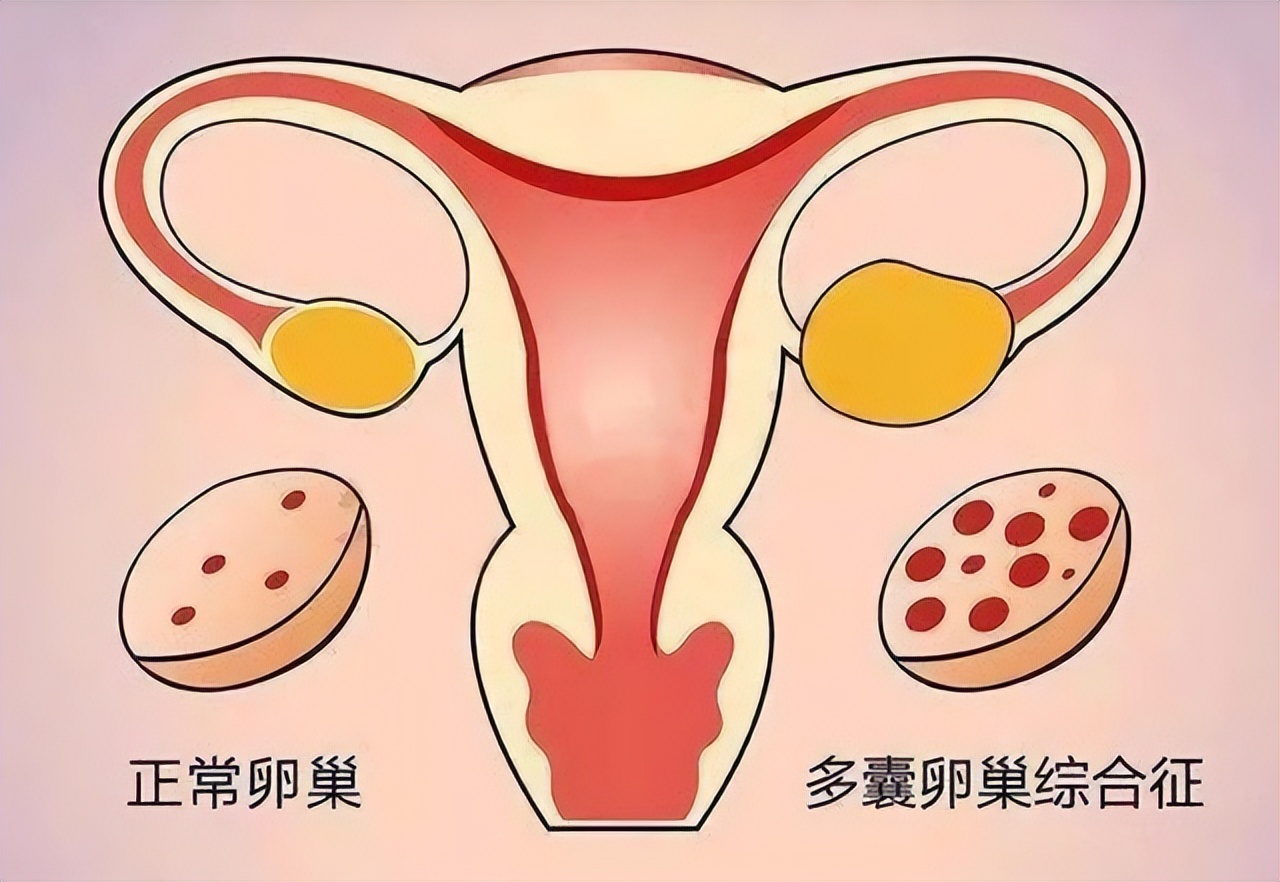 为何有的女性体毛旺盛，有的却“光秃秃”？这是怎么回事，了解下