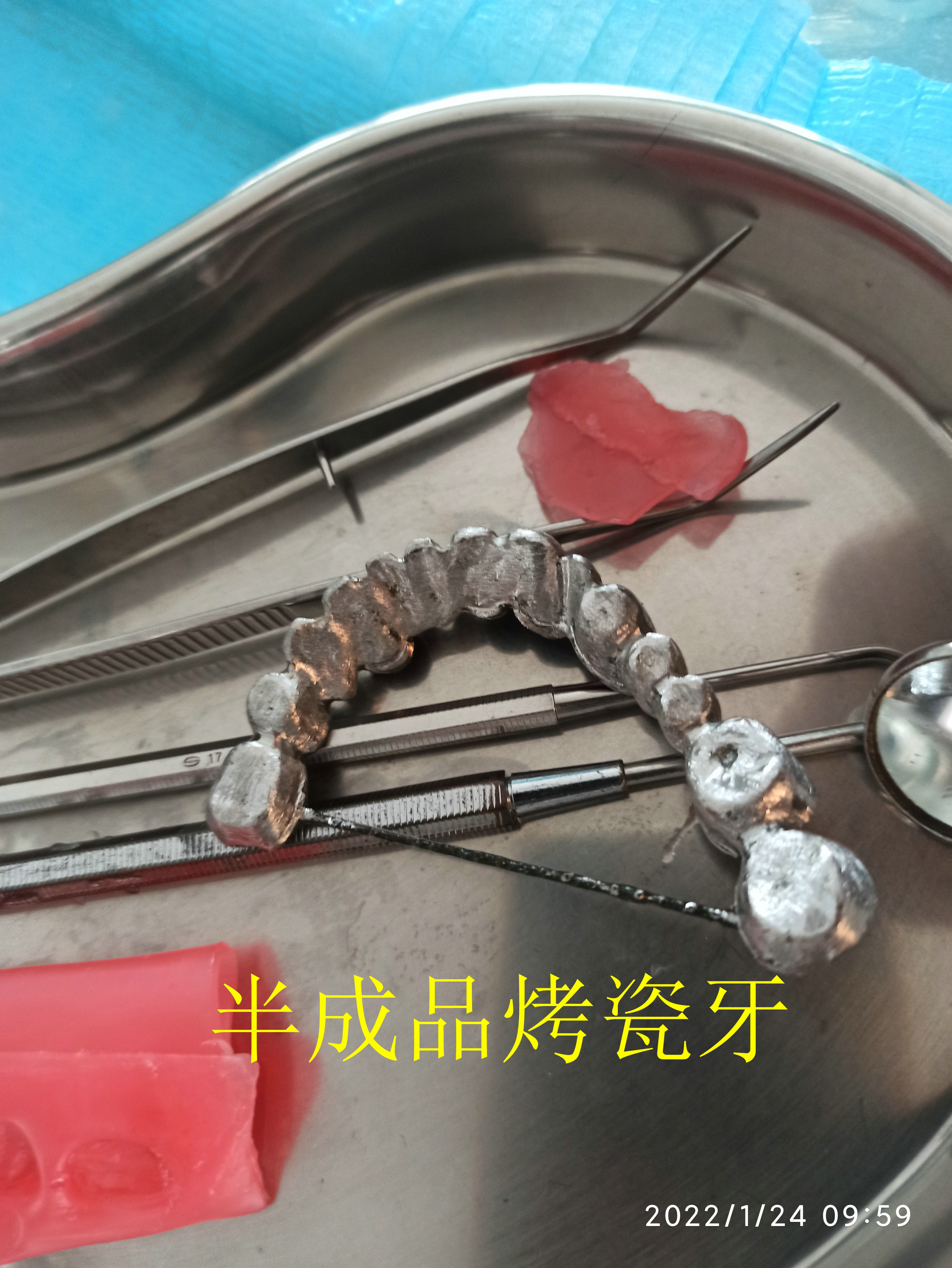 32岁拔了10颗牙，还花8500去镶假牙，我这是遭的哪门子罪呀