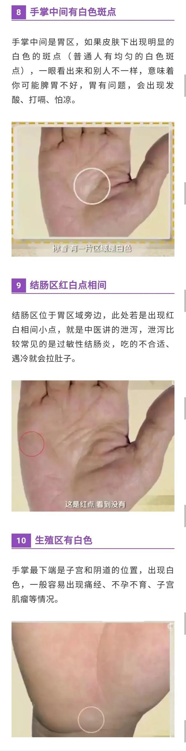 手诊：常见的10种疾病，中医建议收藏，学习