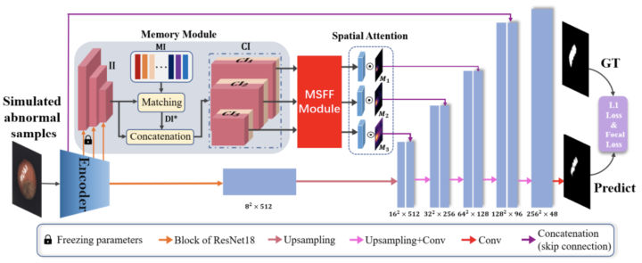 SOTA性能！半监督工业图像表面缺陷检测新方法MemSeg